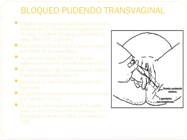 anestesia pudenda